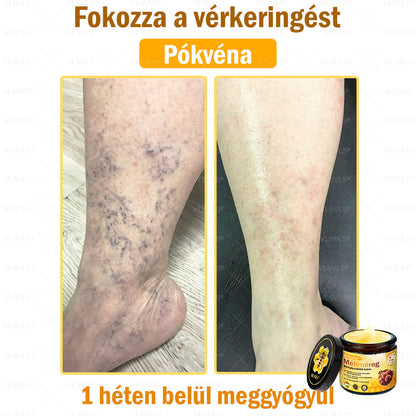 👍💪VLSVLS® Méhméreg Bőrhelyreállító Krém (👨‍⚕‍CE jóváhagyott)✅