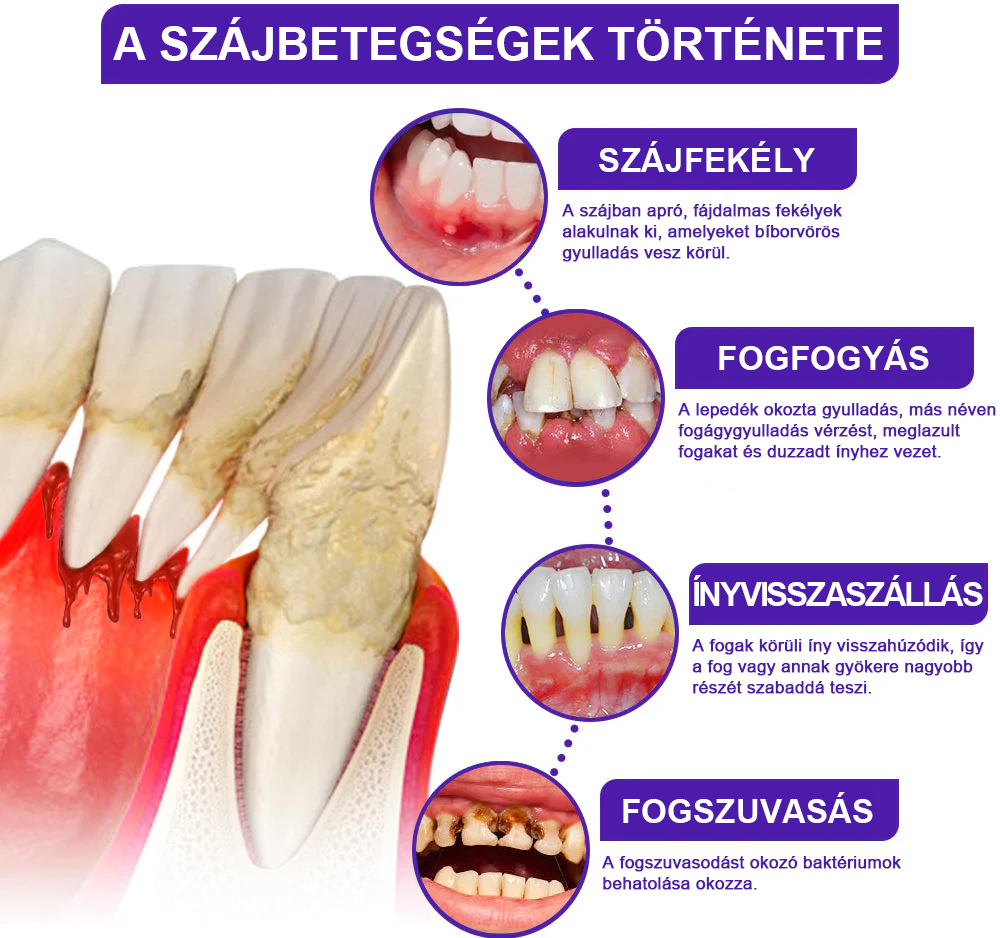 🌟Rolimey® VioCore Méhméreg Fogkezelő Fogkrém