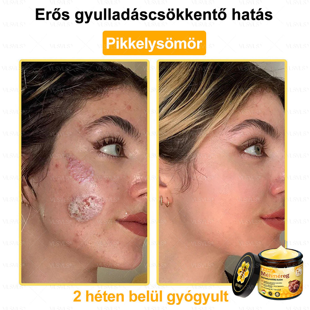 👍💪VLSVLS® Méhméreg Bőrhelyreállító Krém (👨‍⚕‍CE jóváhagyott)✅