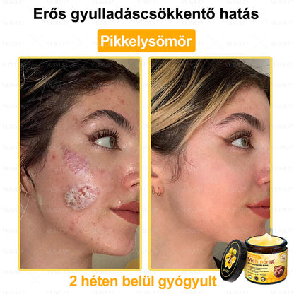 👍💪VLSVLS® Méhméreg Bőrhelyreállító Krém (👨‍⚕‍CE jóváhagyott)✅