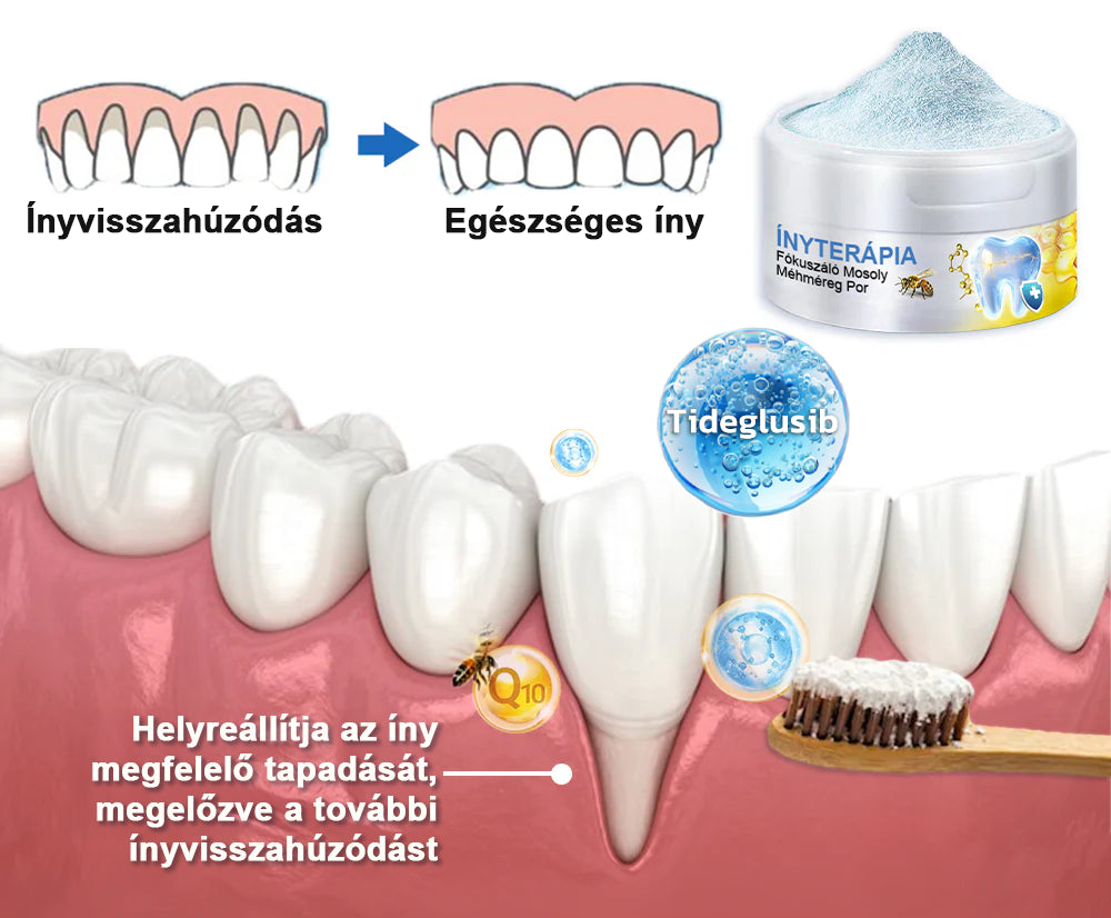 🇭🇺 Furzero® 𝑭𝒐𝒄𝒖𝒔𝒔𝒎𝒊𝒍𝒆 – Méhméreges szájápoló por 🦷🦷🦷