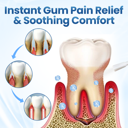 Természetes ínycsillapító spray