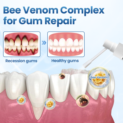 Természetes ínycsillapító spray