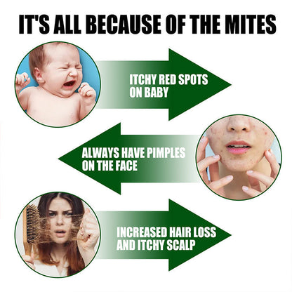 ⚡Limitált akci🧑‍⚕️Erős atkák eltávolító spray