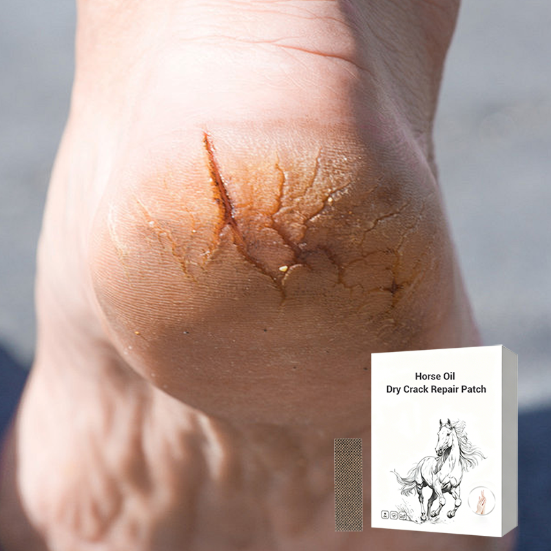 🌿 Lóolajos kéz- és lábápoló tapasz 🩹 Intenzív hidratálás száraz, repedezett bőrre, hosszan tartó enyhülés 🛡️🦟
